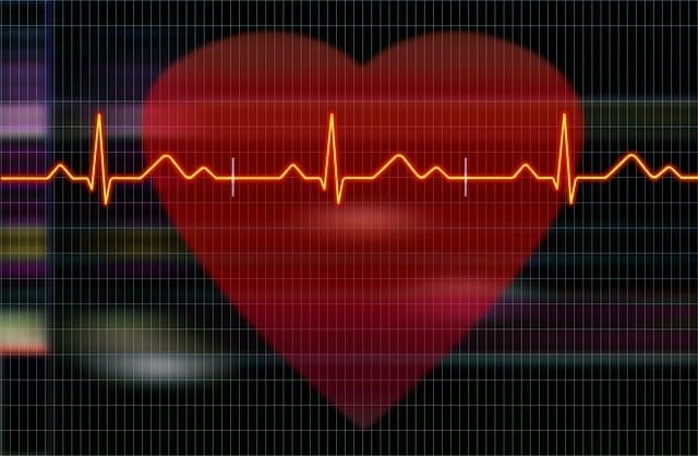  gráfico que muestra los registros del corazón y del electrocardiograma