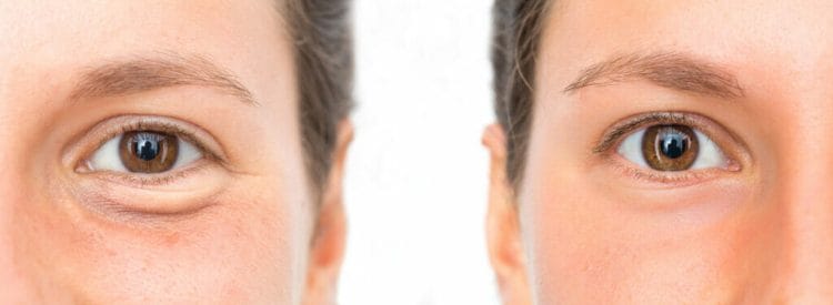  el efecto de un suero antiarrugas